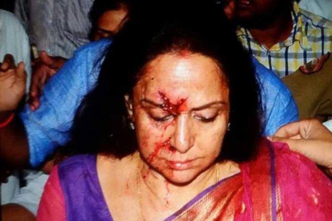 BJP Leader & Bollywood actress Hema Malini suffers injuries in car accident, one ‪Child‬ killed